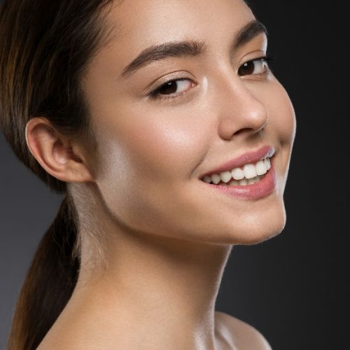 sonrisa con carillas