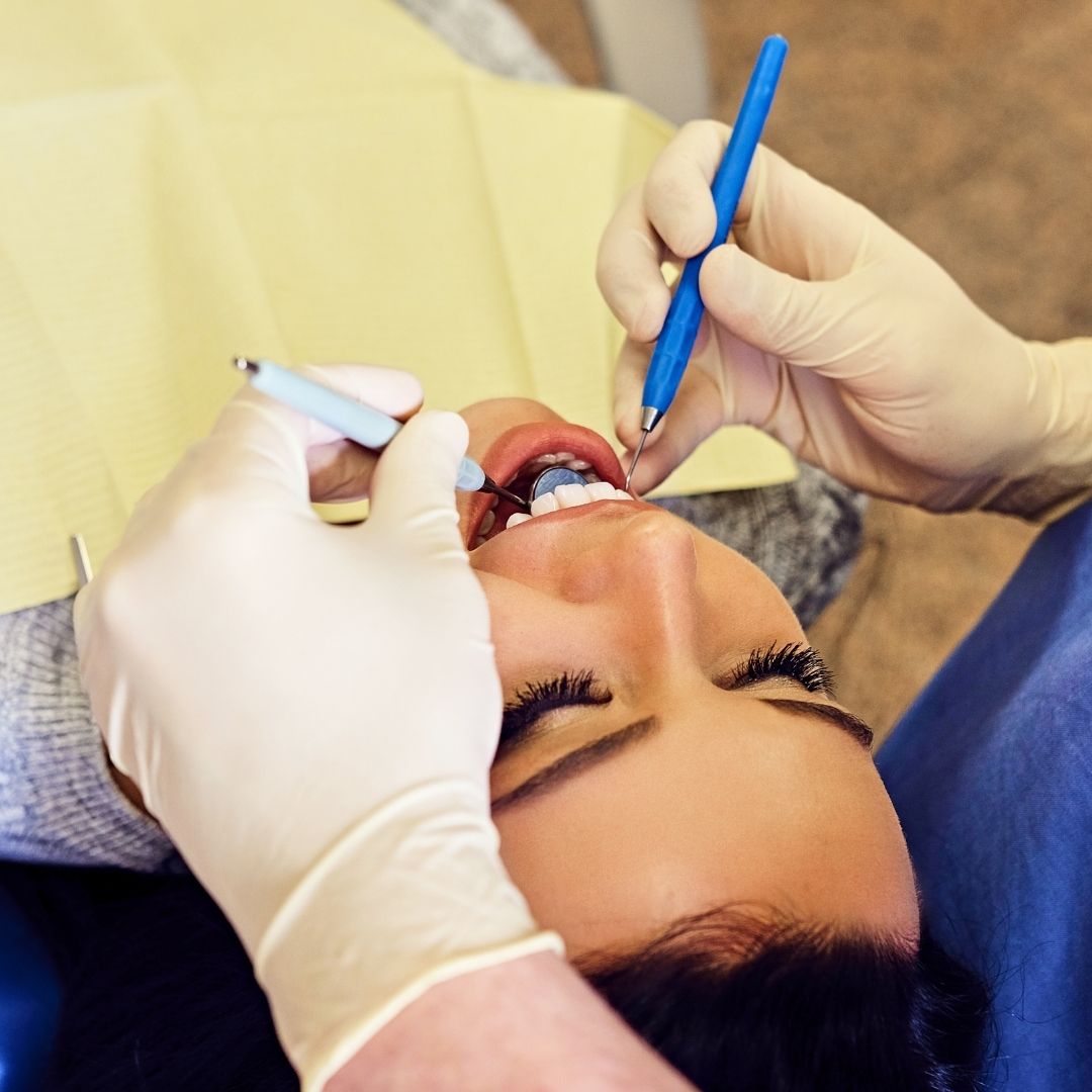 Cuanto tarda una caries en destruir el diente.