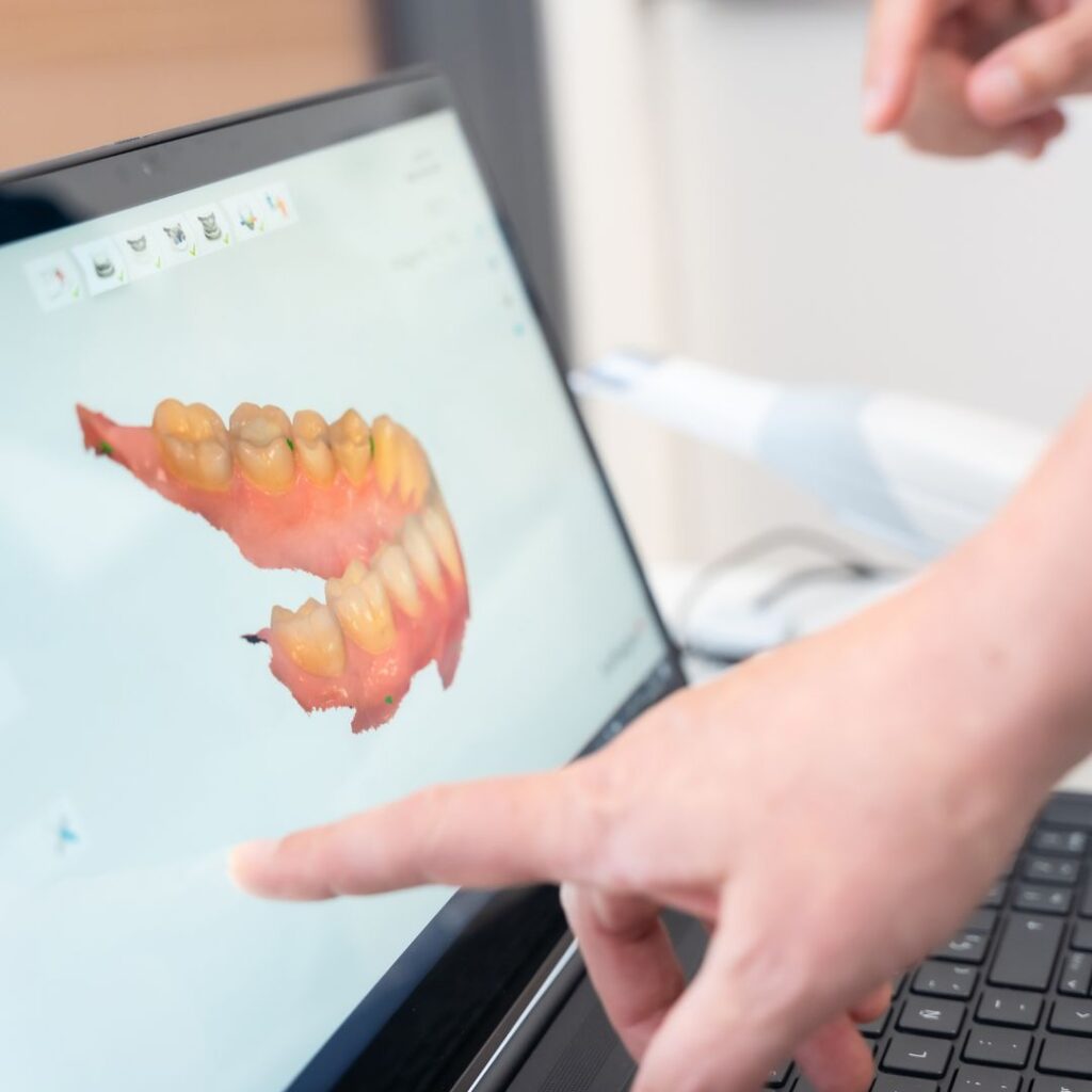 Cirugía de Implantes Guiada