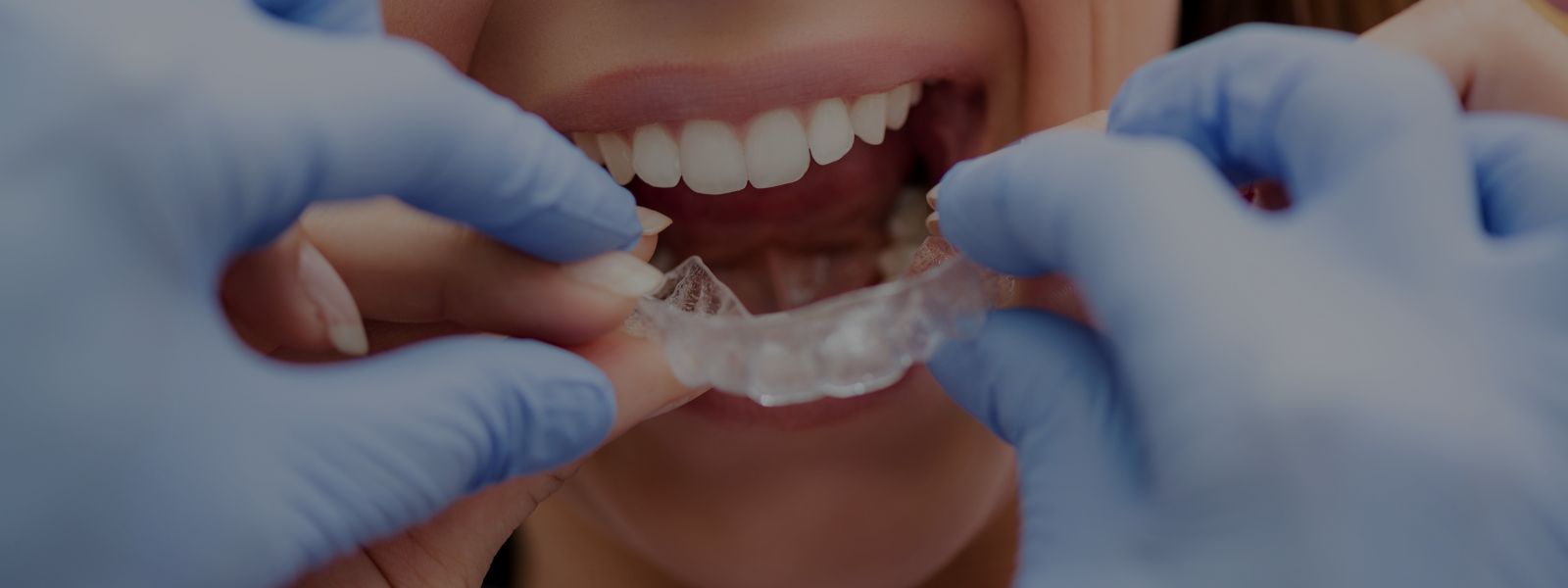 Invisalign para adolescentes