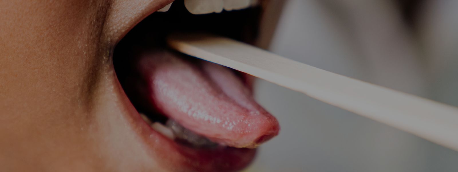 engua podría hacerte padecer enfermedad de las encías